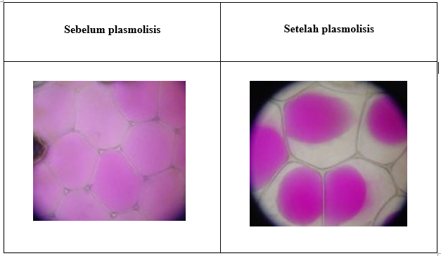 Gambar Rhoeodiscolour, sp sebelum dan setelah plasmolisis, Source: Wikipedia
